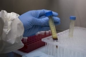 ebola